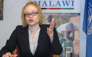 Au Malawi, les albinos menacés d’extermination par la sorcellerie - L'Onu s'en inquiète