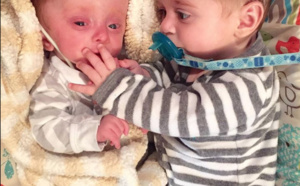Le bébé était né sans cerveau et sa mère ne pouvait pas le supporter. Puis ce couple est arrivé.