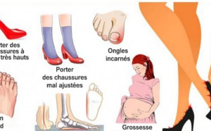 Causes des douleurs aux pieds et comment y remédier