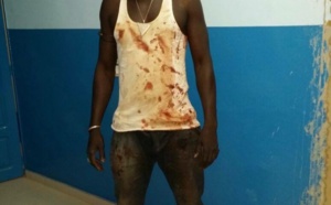 Tentative d'assassinat contre un ex-putschiste gambien à Mbour : Musa Sarr échappe de peu à la mort