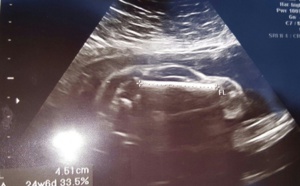 Hilarant : un père voit une voiture sur l’échographie au lieu du bébé