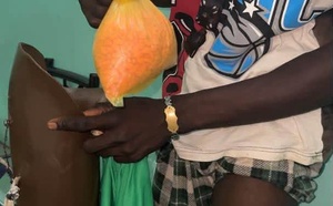 Karang : les Douanes saisissent 1 590 pilules d’ecstasy dissimulées dans une prothèse de jambe