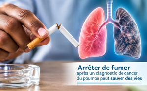 Cancer du poumon : l'arrêt du tabac après le diagnostic réduirait le risque de décès de moitié