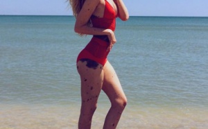 Une Ukrainienne avec une anomalie génétique devient une star d’Instagram