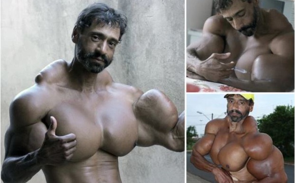 PHOTO : Valdir Segato, ce bodybuilder brésilien est incroyable, il s'injecte de l'huile dans les muscles, on dirait HULK.