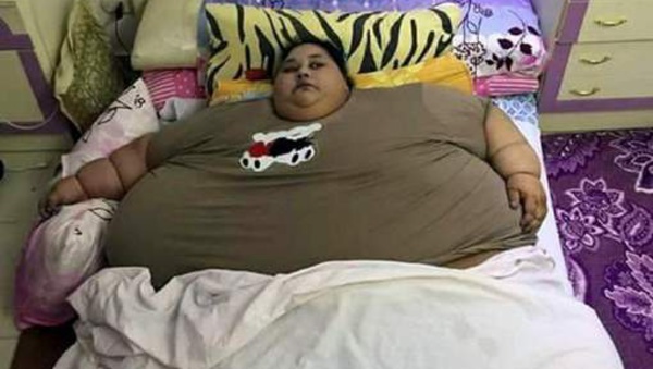 A 36 ans, elle pèse 501,6 kilos… et ne sort plus de chez elle depuis 25 ans