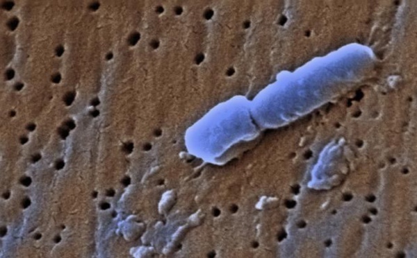 Une Américaine tuée par une bactérie résistante à 26 antibiotiques