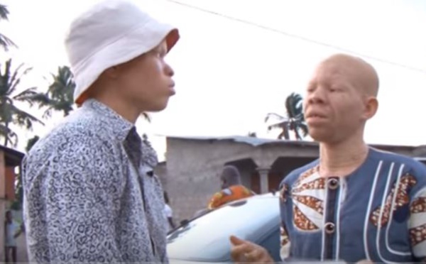 Enquête sur la vie des Albinos en Afrique