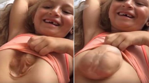Russie: une fille de 8 ans née avec le cœur hors de la poitrine (vidéo)