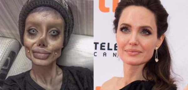 Vidéo-Elle fait plus de 50 opérations pour ressembler à Angelina Jolie