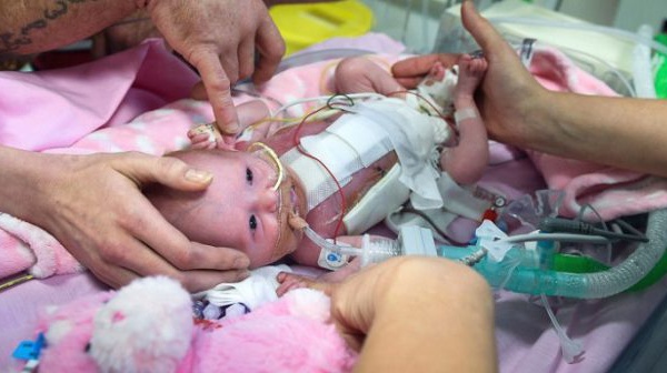 Royaume-Uni: un bébé né avec le cœur hors de la poitrine, survit miraculeusement