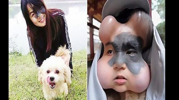 Chine: 4 ballons implantés dans le visage d’une femme pour sauver sa vie