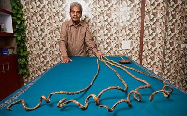 L'homme aux ongles les plus longs du monde a fini par les couper (vidéo)
