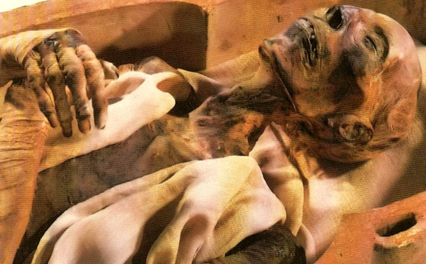 Ramsès II, la momie qui défie le temps depuis plus de 3000 ans