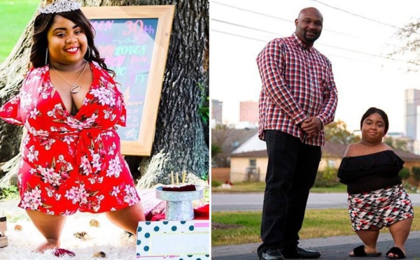 Photos : Une femme née sans bras ni genoux trouve l’amour
