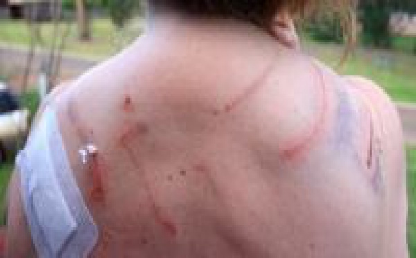 Une Australienne violemment agressée par... un kangourou