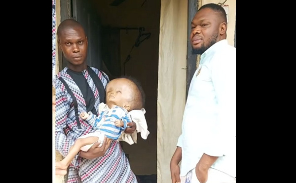 Nigéria: Il refuse une transfusion sanguine pour son enfant malade à cause de ses convictions religieuses (Vidéo)