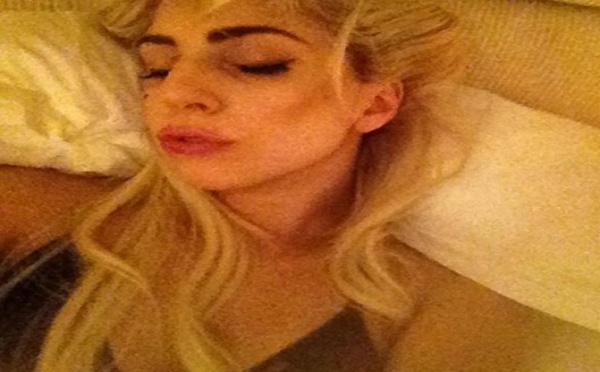 Lady Gaga s'est-elle fait refaire les lèvres ?