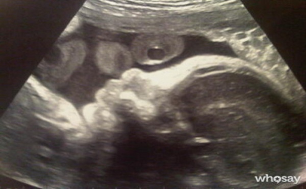 PHOTO Shakira enceinte : les premières photos de son bébé