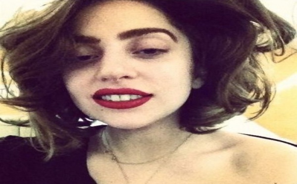 Lady Gaga : blessée, elle annule une partie de ses concerts