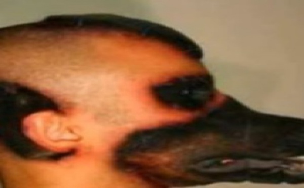 Vidéo: Il se fait greffer une tête de chien! Regardez comment il a fait