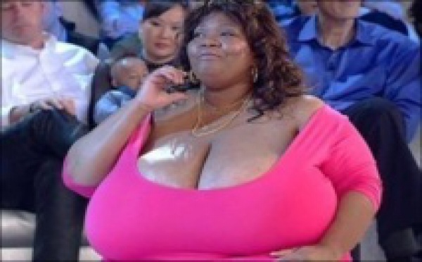 Image d'une femme aux seins qui pèsent chacun… 26 kg!