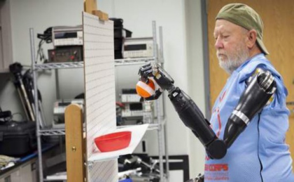 Un homme greffé de deux bras bioniques