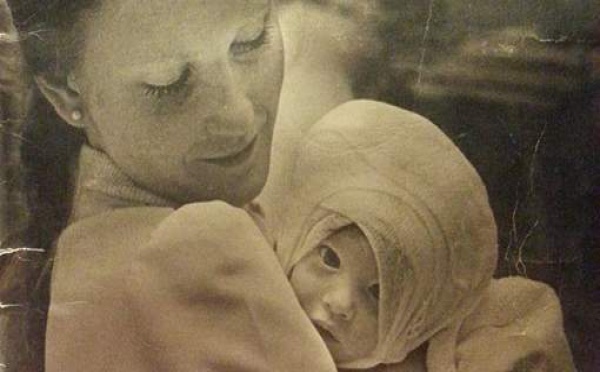 Sévèrement brûlée bébé, elle retrouve 40 ans plus tard l'infirmière qui l'a réconfortée