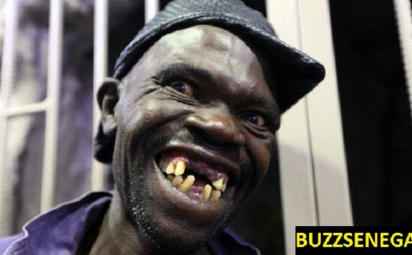 Concours d'homme le plus laid....au Zimbabwe 
