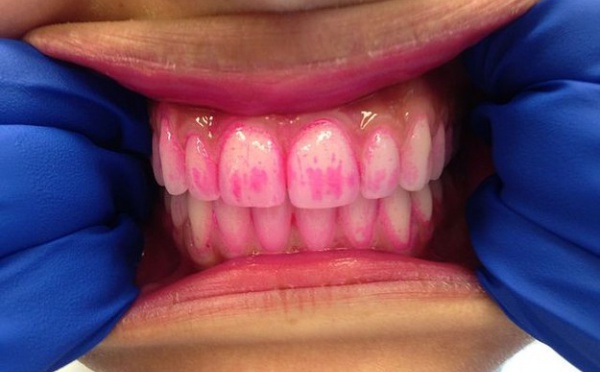8 choses que vous ne saviez peut-être pas sur vos dents