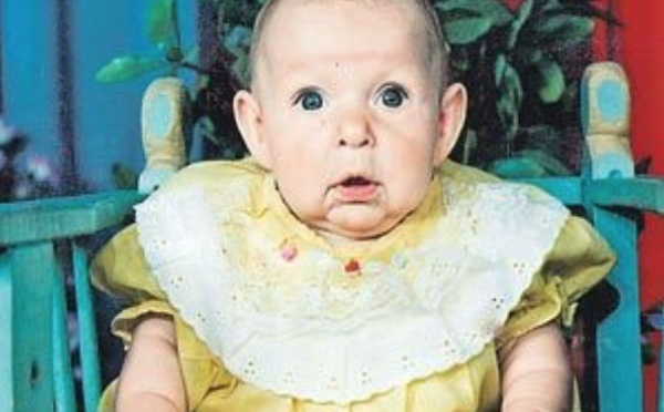 Lorsqu’il voit le visage de sa fille à la naissance, le père a peur et abandonne sa famille. Ce qui leur est arrivé 21 ans plus tard est un miracle.