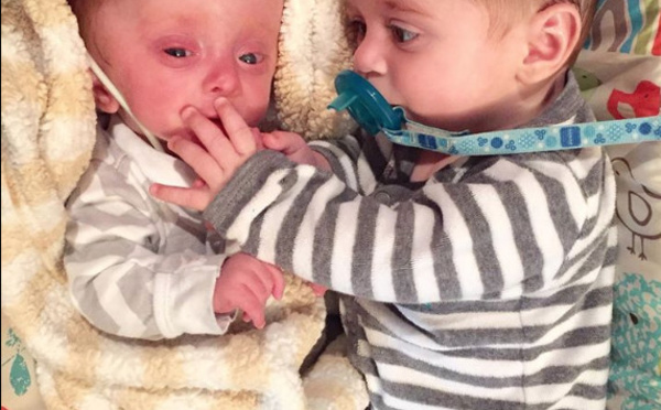 Le bébé était né sans cerveau et sa mère ne pouvait pas le supporter. Puis ce couple est arrivé.