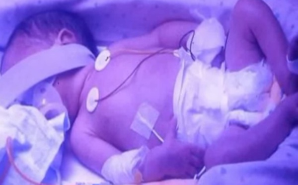 Miracle : ce bébé naît 107 jours après la mort clinique de sa mère