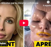 Chirurgie esthétique : 8 femmes victimes de dérives graves