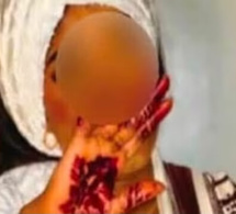 Touba: Ndèye Amy Dione accuse un proche de l’avoir empoisonnée avant de mourir