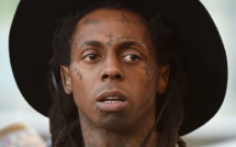 Lil Wayne annonce qu’il lui reste seulement un mois à vivre, à cause d'une tumeur de la peau