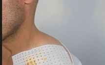 Poignardé à l’épaule, il subit une opération pour sortir la lame de couteau