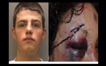 A 18 ans, il tabasse et viole une femme de 58 ans