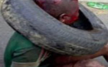 Photos: Un petit garçon de 7 ans battu et brûlé pour avoir...( âmes sensibles s'abstenir)