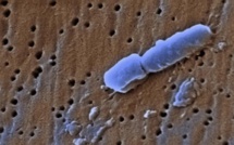 Une Américaine tuée par une bactérie résistante à 26 antibiotiques