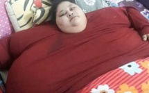 Insolite : Une Egyptienne de 500 kg commence en Inde sa préparation chirurgicale pour perdre du poids