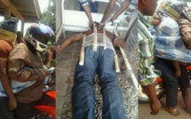 Photos: Incroyable, on transporte des cadavres à moto au Congo