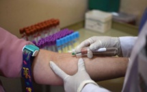 Drépanocytose: des chercheurs africains essaient un dépistage ultra-rapide et moins coûteux