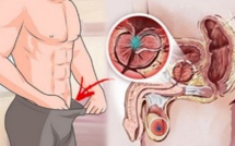 12 symptômes avant-coureurs du cancer de la prostate que tous les hommes doivent connaître ! Ne les ignorez pas.