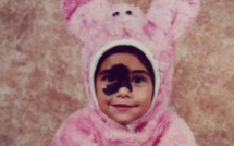 Née avec une impressionnante tache de naissance au visage, Mariana a vécu l'enfer dans sa jeunesse: à 24 ans, elle s'assume enfin