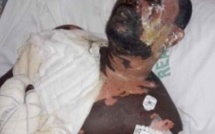 Matam: Un imam ébouillanté pour s’être excusé de diriger la «nafila »