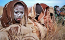 Drame: 11 adolescents morts d'une circoncision ratée en deux semaines