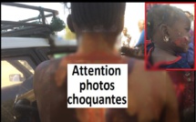 Anta Seck : « Ma colocataire qui me prenait pour la maîtresse de son mari, m'a versé de l'huile sur le visage»