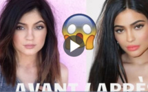 Avant / Après : Kylie Jenner, son incroyable transformation physique