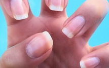 Voici 10 changements sur vos ongles qui pourraient cacher des problèmes de santé